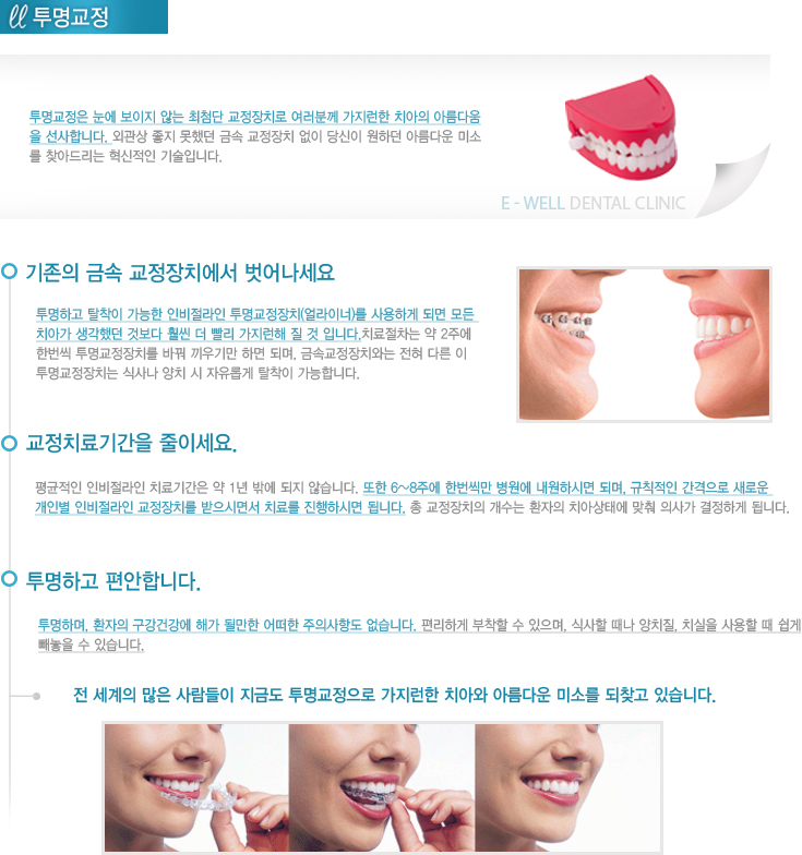 당산동 근처 치과임플란트 부작용 확률 줄이는 방법